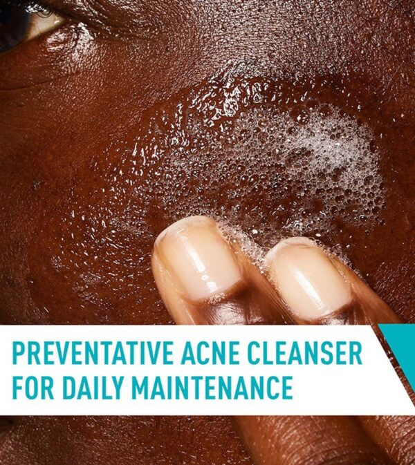 CeraVe Acne Control Cleanser 236 ML: - Image 5