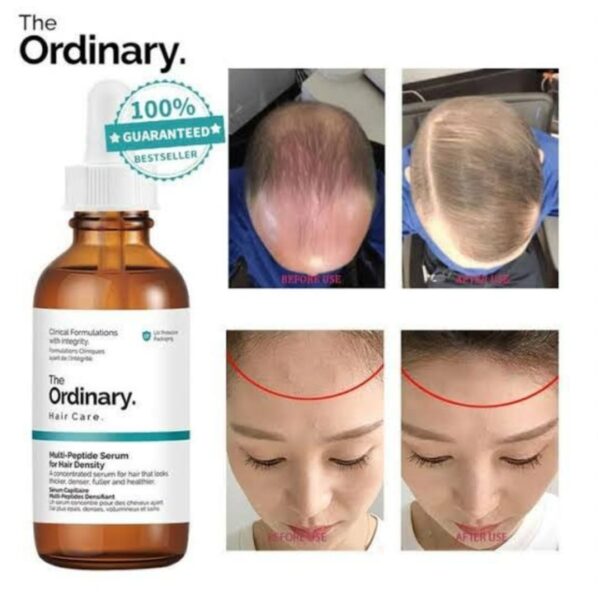 The Ordinary- Hair Growth Serum Multi-Peptide Serum - 60ml