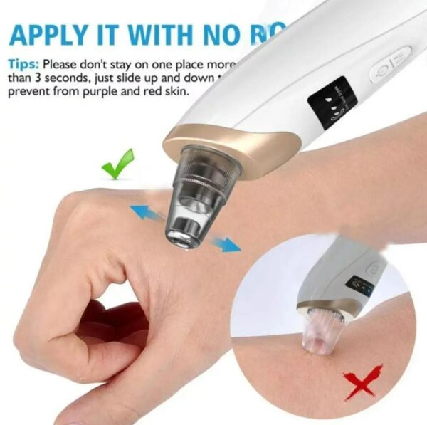 Newest Blackhead Remover Pore Vacuum, Upgraded Facial Pore Cleaner-5 Suction Power, USB Rechargeable Blackhead Vacuum Kit Electric Acne Extractor Tool for Women & Men