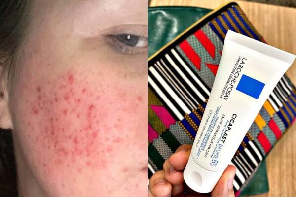 La Roche Posay Cicaplast Balm B5 - Image 4