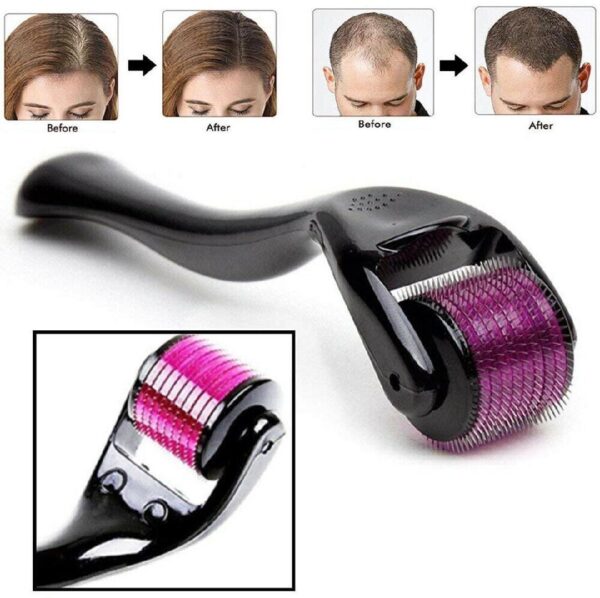 Derma Roller - Reduce Fine Lines for Smooth Skin - Image 2