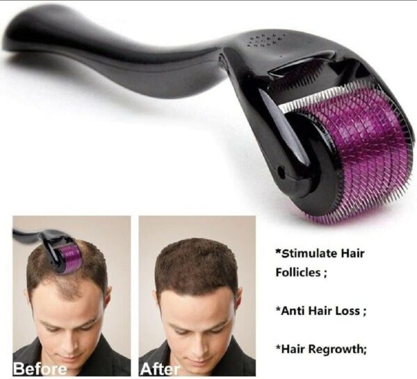 Derma Roller - Reduce Fine Lines for Smooth Skin - Image 4