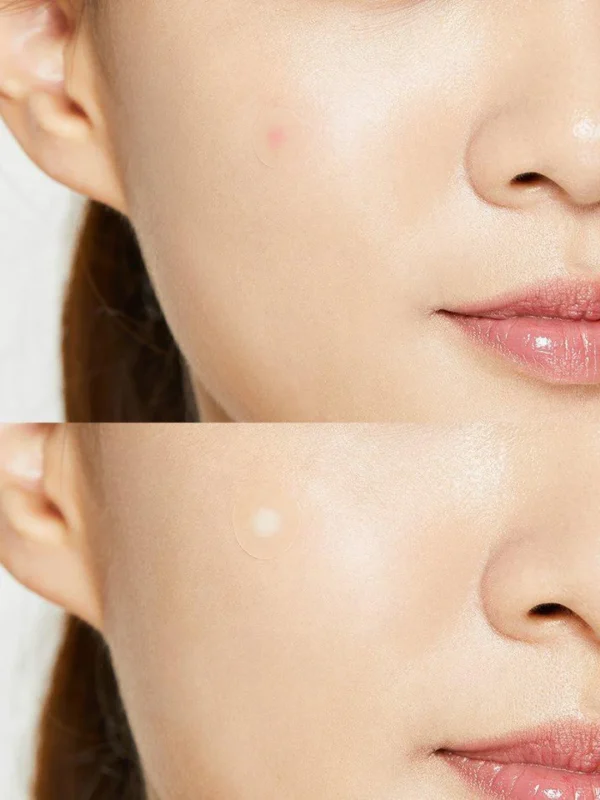 COSRX Acne Pimple Master Patch - Image 6