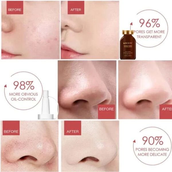 MUICIN Shrink Pores Hyaluronic Acid Serum. - Image 3
