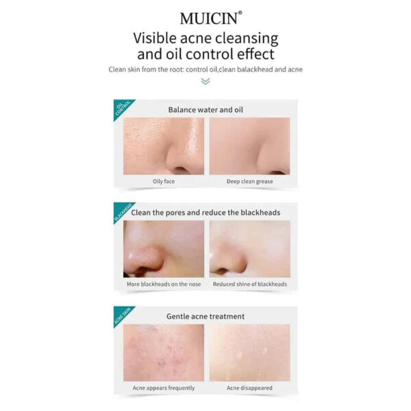 MUICIN Tea Tree Bubble Foaming Facial Cleanser. - Image 6