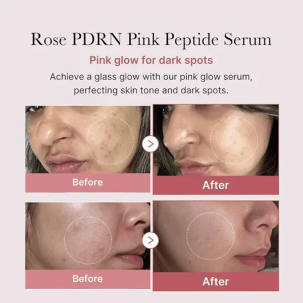 Medicube Pdrn Pink Peptide Serum (30ml) - Image 5
