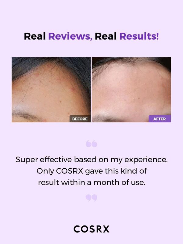 Cosrx AHA/BHA Clarifying Treatment Toner 150 ml. - Image 4