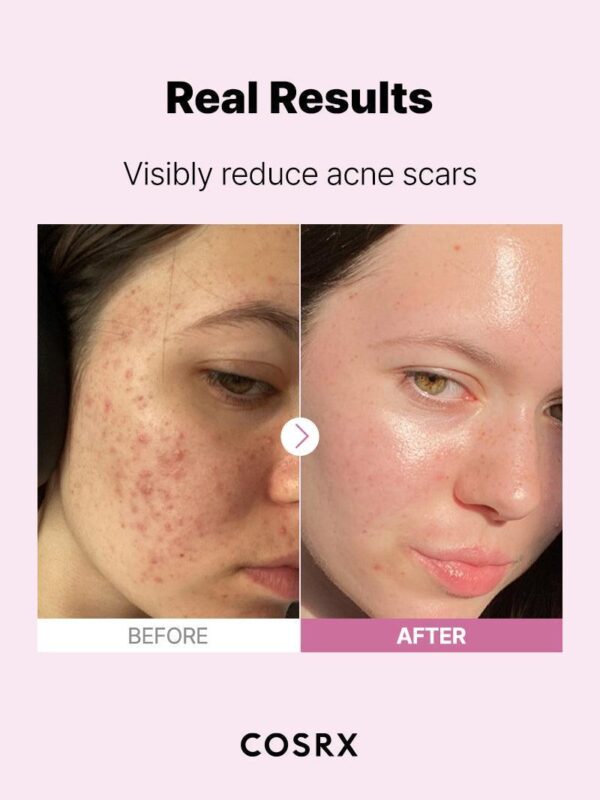 Cosrx The Niacinamide 15 Serum 20 ml. - Image 13