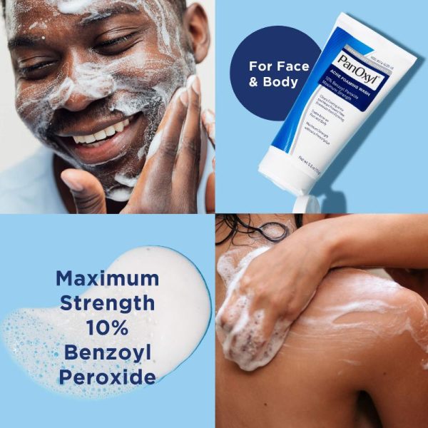 PanOxyl, Acne Creamy Wash, Benzoyl Peroxide 4% Daily Control - Image 4