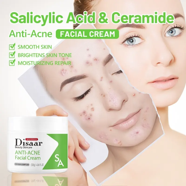 Disaar Anti Acne Facial Cream Salicylic Acid Facial Cream Brightens Skin Tone, 120 g. - Image 6