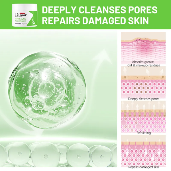 Disaar Anti Acne Facial Cream Salicylic Acid Facial Cream Brightens Skin Tone, 120 g. - Image 5