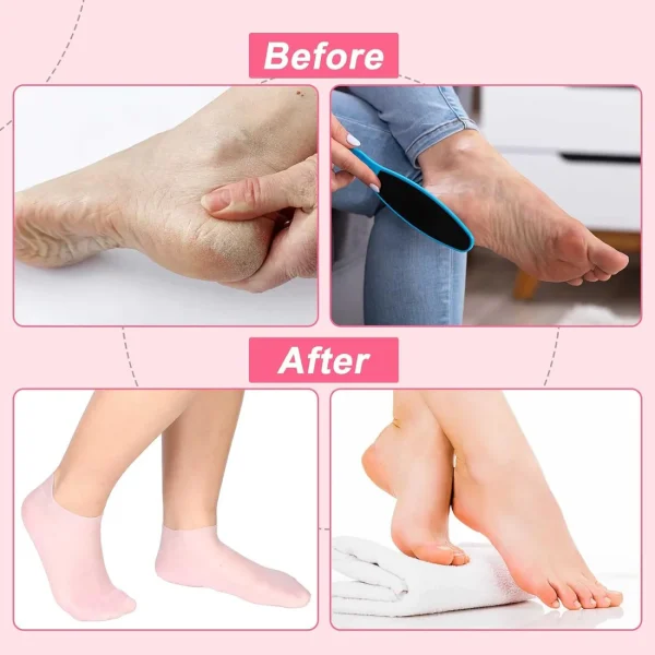 Silicone Moisturizing Soft Gel Socks - Image 5