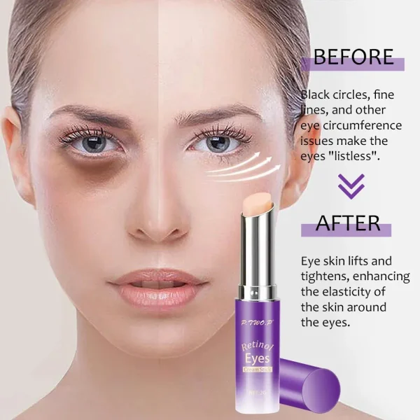 Retinol Moisturizing Eye Cream Stick, Fade Fine Line Repair, Anti-Wrinkle, Brightening Eye Care. - Image 3