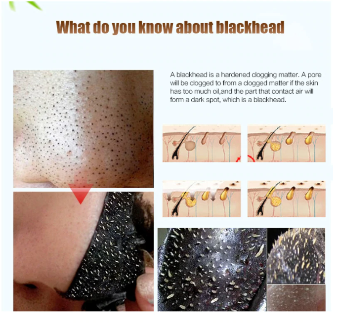 Skillmans Black Peel-off Mask 75ML Tube: - Image 2