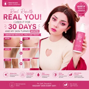Whitening & Freckle Body Lotion – Brightening & Dark Spot Care