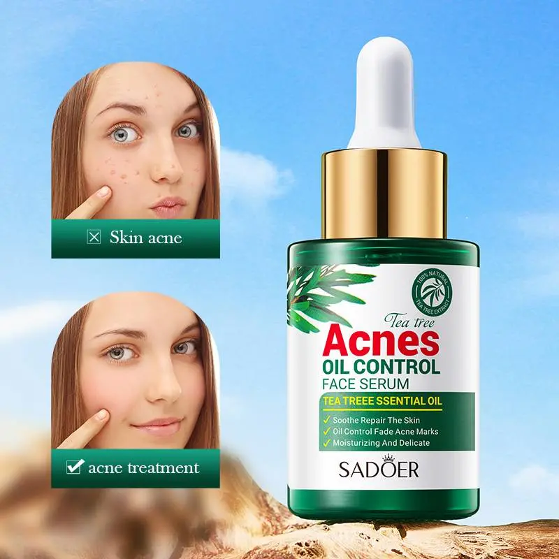 SADOER Tea Tree Serum - Oil Control & Anti-Acne Face Serum - 30ml - Image 3